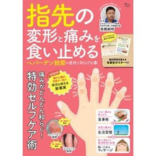 画像をギャラリービューアに読み込む, 指先の変形と痛みを食い止める ヘバーデン