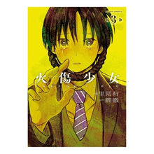 画像をギャラリービューアに読み込む, 火傷少女 3
