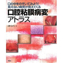 画像をギャラリービューアに読み込む, 口腔粘膜病変アトラス 口の中をのぞいてみ