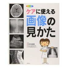画像をギャラリービューアに読み込む, ケアに使える画像の見かた