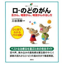 口・のどのがん　舌がん、咽頭がん、喉頭が