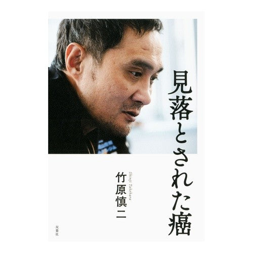 見落とされた癌