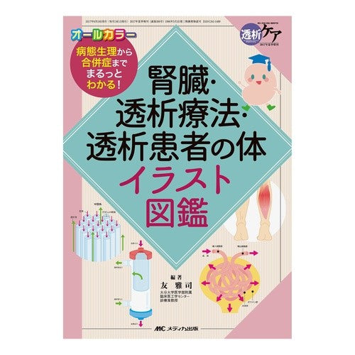 腎臓・透析療法・透析患者の体イラスト図鑑 Kidney/dialysis therapy/dialysis patient body illustration book