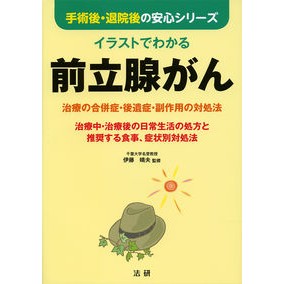 イラストでわかる前立腺がん－治療の合併症 Itou Haruo Illustrated explanation of prostate cancer - Complications treatment